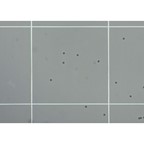 Ward's White Blood Cell Counts as a Diagnostic Tool Lab Activity